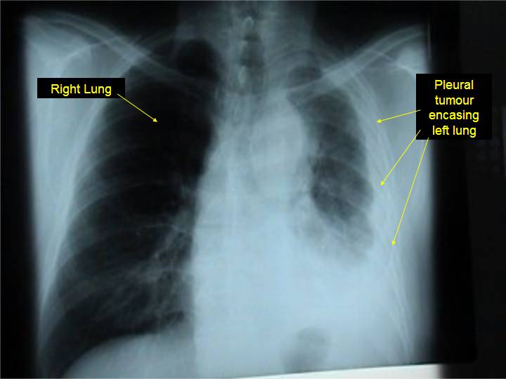 example of an x-ray