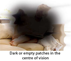 Image 1: Dark or empty patches in the centre of vision