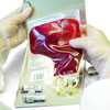 Artificial  blood substitutes
