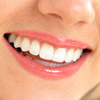 My experience: Teeth whitening