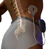 Spinal cord stimulation devices