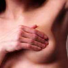 Breast and nipple thrush