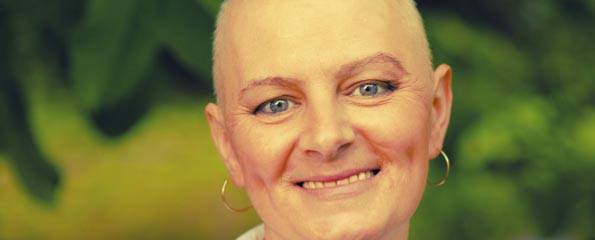 Bald woman - cancer survivor