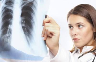 female doctor looking at lung x-ray