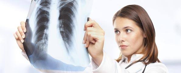 female doctor looking at lung x-ray