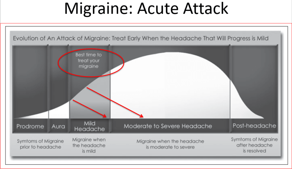 Acute migraine - best time to treat